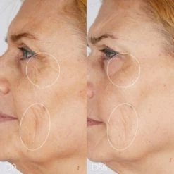 CAUDALIE Premier Cru Die Creme Nachfüllpackung 50 Ml -Modekosmetik 2575175 CAUDALIE Premier Cru Die Creme Nachfuellpackung 50 ml.c97d1f83